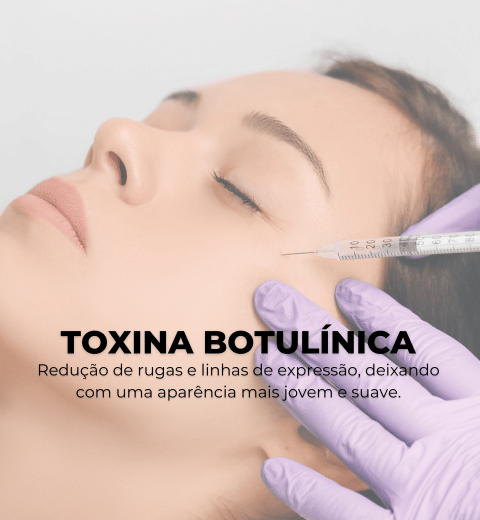 TOXINA BOTULÍNICA Redução de rugas e linhas de expressão, deixando com uma aparência mais jovem e suave.